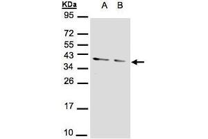 Western Blotting (WB) image for anti-Protein Phosphatase 1, Catalytic Subunit, alpha Isoform (PPP1CA) (Center) antibody (ABIN2856071)