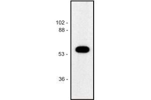 Western blot of human Jurkat T cell line (alpha Tubulin 抗体)