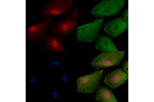 ABIN6259295 and ABIN6273500 staining  cells by IF/ICC. (TAB3 抗体  (Internal Region))