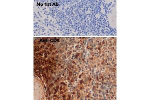 IHC of mouse spleen using anti-CD4 antibody and FFPE tissue after heat-induced antigen retrieval. (CD4 抗体)