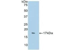 Detection of Recombinant RNASE7, Human using Polyclonal Antibody to Ribonuclease A7 (RNASE7) (RNASE7 抗体  (AA 31-155))