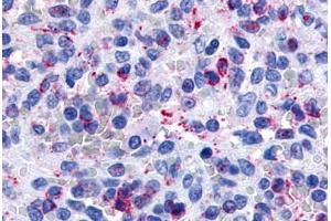 anti-Purinergic Receptor P2Y, G-Protein Coupled, 13 (P2RY13) (Extracellular Domain) antibody