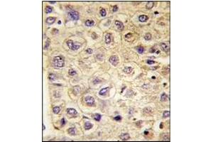 Immunohistochemistry (IHC) image for anti-TYRO3 Protein Tyrosine Kinase (TYRO3) antibody (ABIN356409) (TYRO3 抗体)