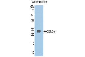 Western Blotting (WB) image for anti-Homogentisate 1,2-Dioxygenase (HGD) (AA 239-428) antibody (ABIN1859143) (HGD 抗体  (AA 239-428))