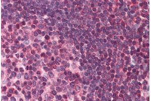 Human Small Intestine, Peyer's Patch (formalin-fixed, paraffin-embedded) stained with DAPK3 antibody ABIN214482 at 2. (DAPK3 抗体  (Internal Region))