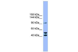 ENPP2 antibody used at 1 ug/ml to detect target protein. (ENPP2 抗体  (N-Term))