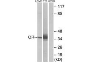 Western Blotting (WB) image for anti-Olfactory Receptor, Family 4, Subfamily D, Member 6 (OR4D6) (AA 260-309) antibody (ABIN1535907)