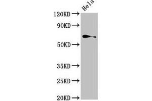 Western Blot Positive WB detected in: Hela whole cell lysate All lanes: TRIP4 antibody at 4 μg/mL Secondary Goat polyclonal to rabbit IgG at 1/50000 dilution Predicted band size: 67 kDa Observed band size: 67 kDa (TRIP4 抗体  (AA 360-535))