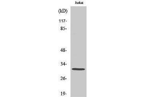 Western Blotting (WB) image for anti-Complement Component 1, Q Subcomponent Binding Protein (C1QBP) (Internal Region) antibody (ABIN3183587)