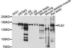Western blot analysis of extracts of various cell lines, using PLB1 antibody (ABIN5998536) at 1/1000 dilution. (Phospholipase B 抗体)