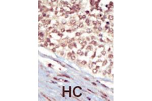 Immunohistochemistry (IHC) image for anti-EPH Receptor A5 (EPHA5) antibody (ABIN3003333) (EPH Receptor A5 抗体)