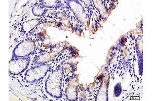 Formalin-fixed and paraffin embedded mouse colon labeled with Anti-Jagged1/CD339 Polyclonal Antibody, Unconjugated (ABIN686677) at 1:200 followed by conjugation to the secondary antibody and DAB staining. (JAG1 抗体)