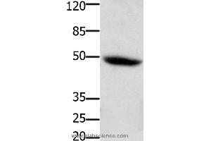 Western blot analysis of Mouse heart tissue, using CSF2RA Polyclonal Antibody at dilution of 1:400 (CSF2RA 抗体)