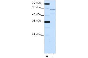 NOVA2 antibody used at 2. (NOVA2 抗体  (Middle Region))