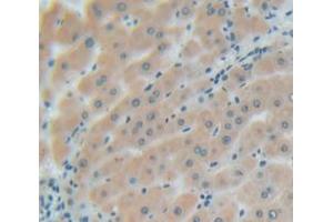 IHC-P analysis of Human Tissue, with DAB staining. (Glypican 3 抗体  (AA 343-559))