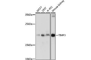 Western blot analysis of extracts of various cell lines, using TIMP3 antibody (ABIN6134857, ABIN6149180, ABIN6149181 and ABIN6215546) at 1:1000 dilution. (TIMP3 抗体  (C-Term))