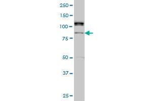 ALS2CR8 monoclonal antibody (M01), clone 2A3 Western Blot analysis of ALS2CR8 expression in Hela S3 NE . (Calcium Responsive Transcription Factor (CARF) (AA 621-718) 抗体)