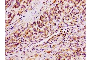 Immunohistochemistry (IHC) image for anti-AT Rich Interactive Domain 3A (BRIGHT-Like) (ARID3A) (AA 26-137) antibody (ABIN7144779)