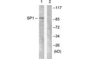 Western blot analysis of extracts from LOVO cells, using SP1 (Ab-453) Antibody. (SP1 抗体  (AA 421-470))