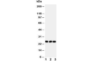 Western blot testing of FGF19 antibody and Lane 1:  rat brain;  2: U87;  3: SMMC-7721 cell lysate (FGF19 抗体  (Middle Region))