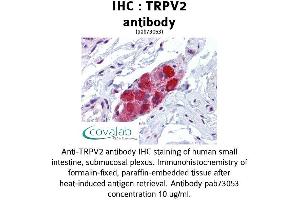 Image no. 1 for anti-Transient Receptor Potential Cation Channel, Subfamily V, Member 2 (TRPV2) (AA 595-764) antibody (ABIN1740401)