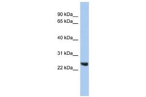 PSMB2 antibody used at 1 ug/ml to detect target protein. (PSMB2 抗体)