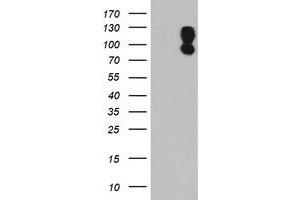 HEK293T cells were transfected with the pCMV6-ENTRY control (Left lane) or pCMV6-ENTRY DPP9 (Right lane) cDNA for 48 hrs and lysed. (DPP9 抗体)