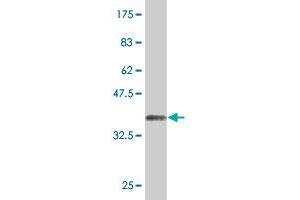 Western Blot detection against Immunogen (36. (KAT2A 抗体  (AA 738-837))