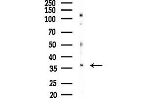 anti-CDC42 Effector Protein (Rho GTPase Binding) 4 (CDC42EP4) (Internal Region) antibody