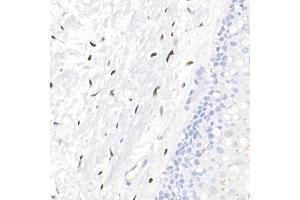 Immunohistochemistry of paraffin-embedded human cervix using Progesterone Receptor Rabbit mAb (ABIN7269533) at dilution of 1:100 (40x lens). (Progesterone Receptor 抗体)