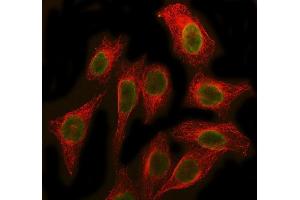 IF analysis of SBDS using anti-SBDS antibody (ABIN7600404) and anti-Beta Tubulin antibody (ABIN7602743). (SBDS 抗体  (AA 19-241))