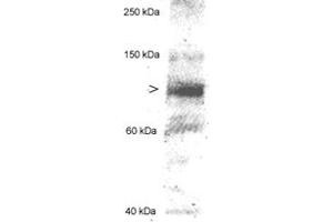 Western blot analysis of MLXIPL in 20 ug of human hepatocyte lysate using MLXIPL polyclonal antibody . (MLXIPL 抗体  (AA 800-852))