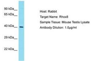 Image no. 1 for anti-Reproductive Homeobox 8 (RHOX8) (N-Term) antibody (ABIN6750248) (RHOX8 抗体  (N-Term))