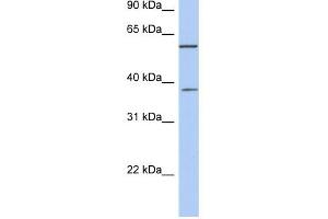 NUP43 antibody used at 1 ug/ml to detect target protein. (NUP43 抗体  (Middle Region))