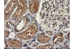 Immunohistochemical staining of paraffin-embedded Human Kidney tissue using anti-CAT mouse monoclonal antibody. (Catalase 抗体)