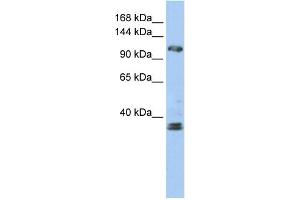 WB Suggested Anti-ZEB2 Antibody Titration:  0. (ZEB2 抗体  (N-Term))