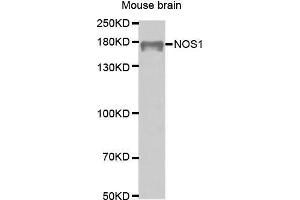 Western Blotting (WB) image for anti-Nitric Oxide Synthase 1, Neuronal (NOS1) (AA 1-180) antibody (ABIN6218566) (NOS1 抗体  (AA 1-180))