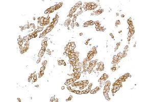 Immunocytochemistry (ICC) image for anti-Syndecan 1 (SDC1) (AA 23-251) antibody (ABIN7795742) (Recombinant Syndecan 1 抗体  (AA 23-251))