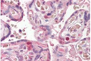 Anti-FANCE antibody IHC staining of human placenta. (FANCE 抗体  (AA 235-247))