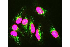 HeLa cells staining with LMNA / Lamin A/C antibody (red), and counterstained with 6E2 monoclonal antibody to Lysosomal Associated Membrane Protein 1 (Lamp1, green) and DNA (blue). (Lamin A/C 抗体)