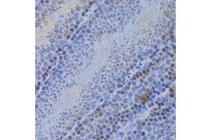 Immunohistochemistry of paraffin-embedded mouse testis using HELLS Antibody (ABIN5973444) at dilution of 1/100 (40x lens). (HELLS 抗体)