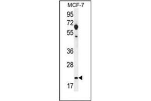 Western blot analysis of hCG_1646420 Antibody (Center) in MCF-7 cell line lysates (35ug/lane). (CLDN25 抗体  (Middle Region))