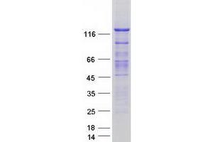 Western Blotting (WB) image for Smoothelin (SMTN) (Transcript Variant 2) protein (Myc-DYKDDDDK Tag) (ABIN2732255)