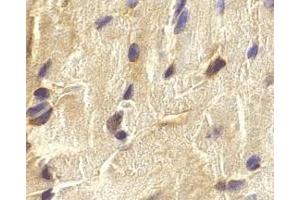 Immunohistochemistry of ECSIT in mouse heart cells with ECSIT antibody at 2 μg/ml. (ECSIT 抗体  (C-Term))