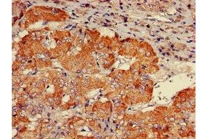 IHC image of ABIN7146261 diluted at 1:600 and staining in paraffin-embedded human adrenal gland tissue performed on a Leica BondTM system. (CHP 抗体  (AA 2-195))