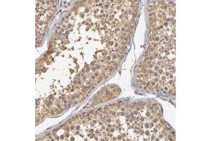 Immunohistochemical staining (Formalin-fixed paraffin-embedded sections) of human testis with GNPDA1 polyclonal antibody  shows moderate cytoplasmic positivity in germ cells at 1:200 - 1:500 dilution.