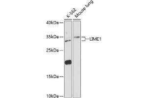 Western blot analysis of extracts of various cell lines, using LIME1 antibody (ABIN6128200, ABIN6143228, ABIN6143229 and ABIN6217817) at 1:3000 dilution. (LIME 抗体  (AA 1-295))