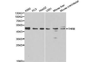 Western blot analysis of extracts of various cell lines, using THRB antibody. (THRB 抗体  (AA 1-250))