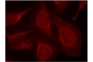 Image no. 1 for anti-BCL2-Like 11 (Apoptosis Facilitator) (BCL2L11) (pSer65), (pSer69) antibody (ABIN197056) (BIM 抗体  (pSer65, pSer69))
