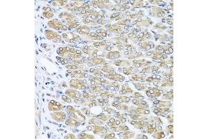 Immunohistochemistry of paraffin-embedded mouse stomach using R antibody (ABIN3021523, ABIN3021524, ABIN3021525 and ABIN6215193) at dilution of 1:100 (40x lens). (RAC2 抗体  (AA 1-192))